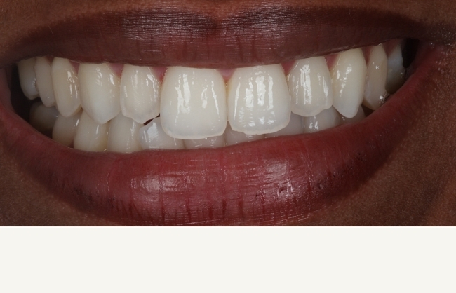 Before