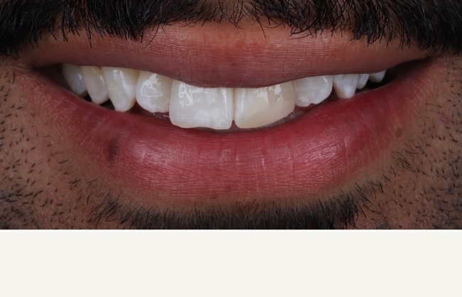 Before