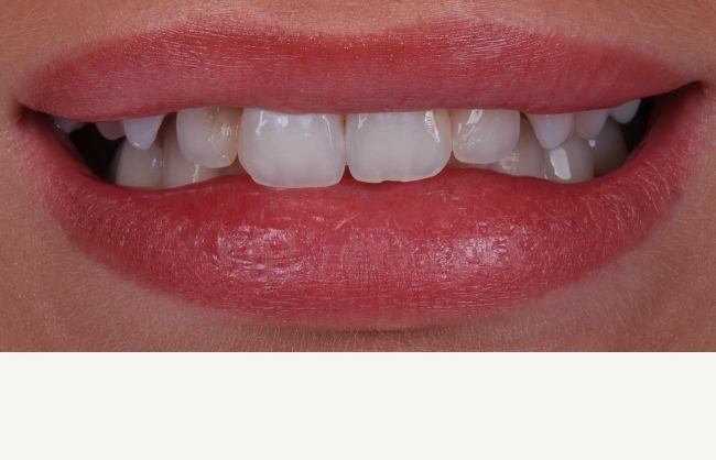 Before