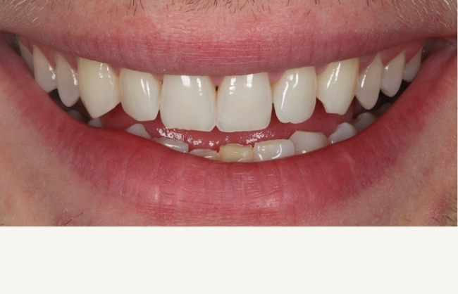 Before