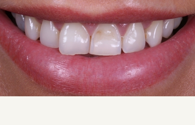 Before