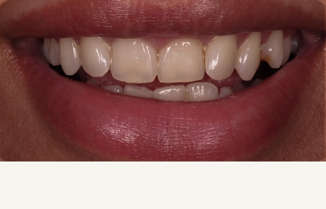 Before