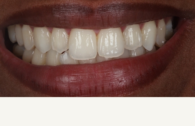 Before