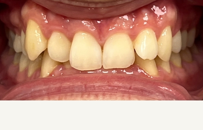 Before