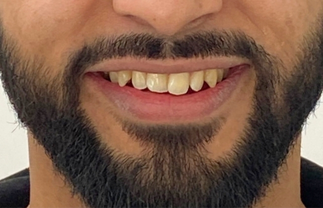 Before