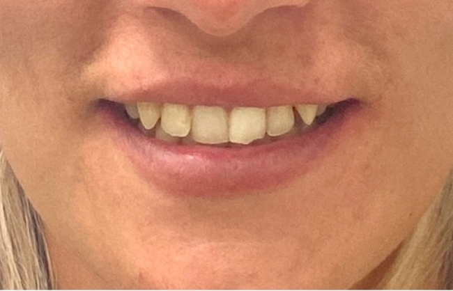 Before
