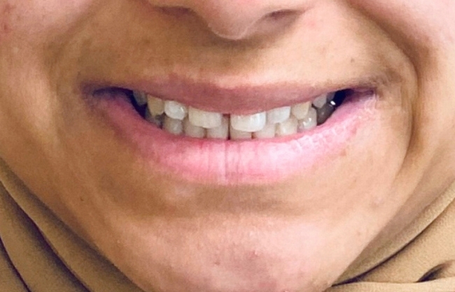 Before