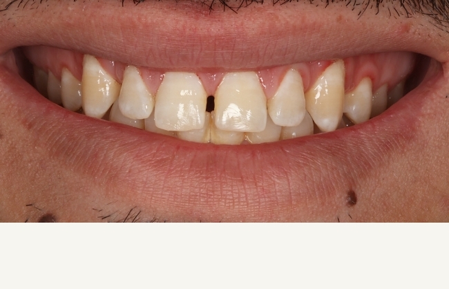 Before