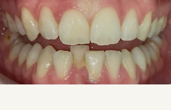 Before
