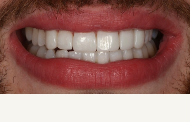 After