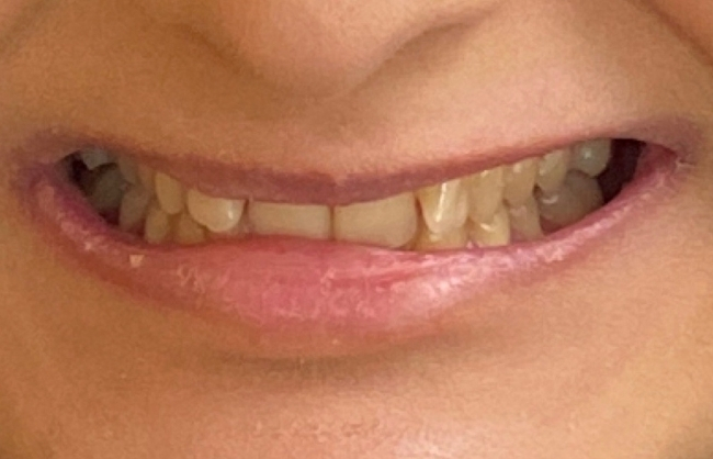 Before
