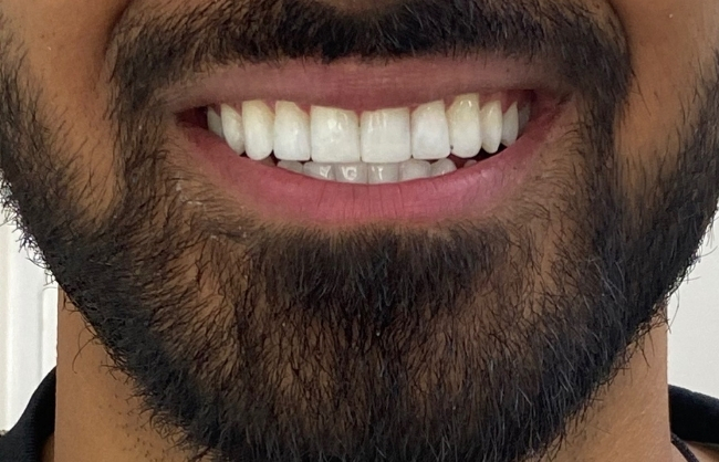 After