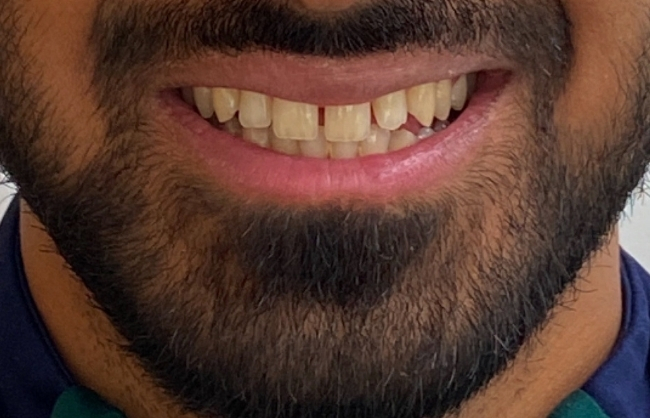 Before