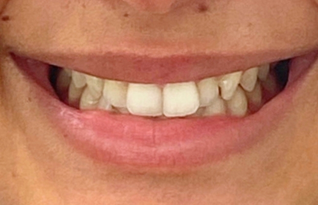 Before