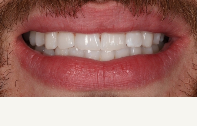 Before