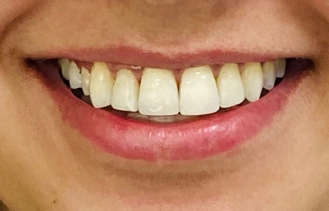 After